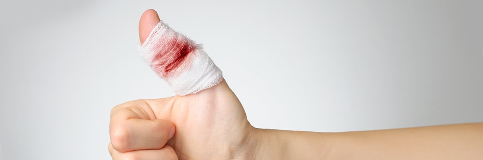 Injured thumb
