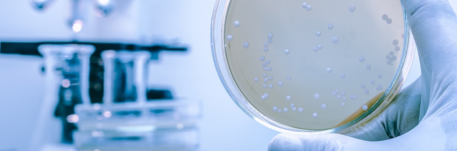 Stability of Cellulose fibrils — microbial degradation